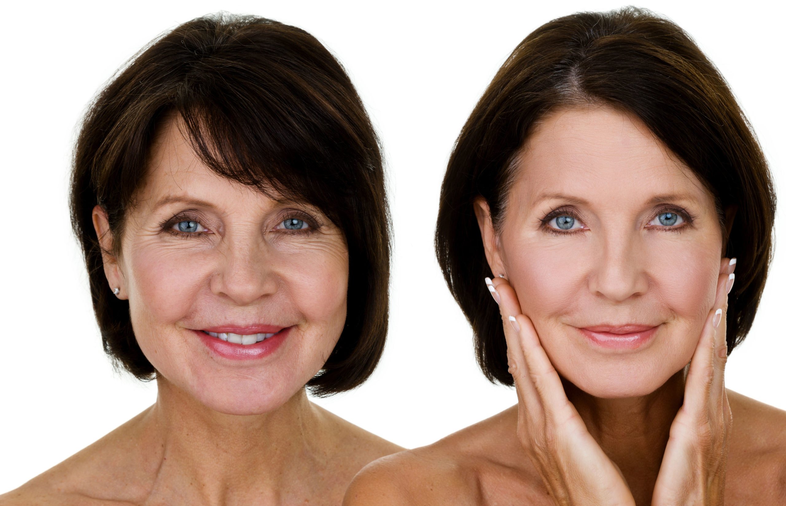Facelift Surgery in Turkey – Cost, Safety, and Recovery Explained | Zeoby