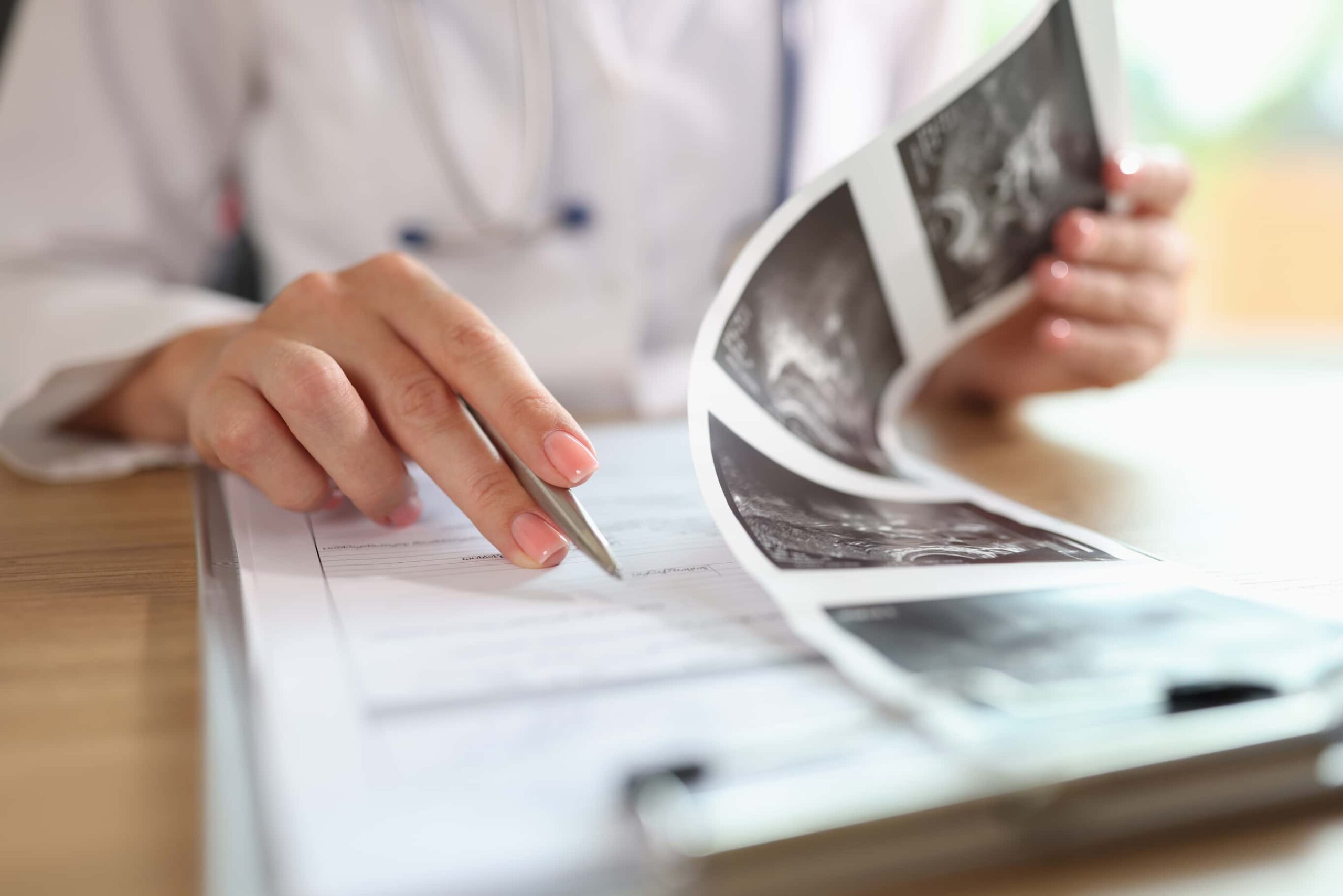 Ablation of Ovarian Tumors in Turkey – Cost, Procedure & Recovery | Zeoby